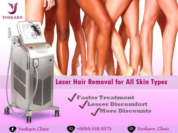 laser hair removal[1].jpg (600×450)